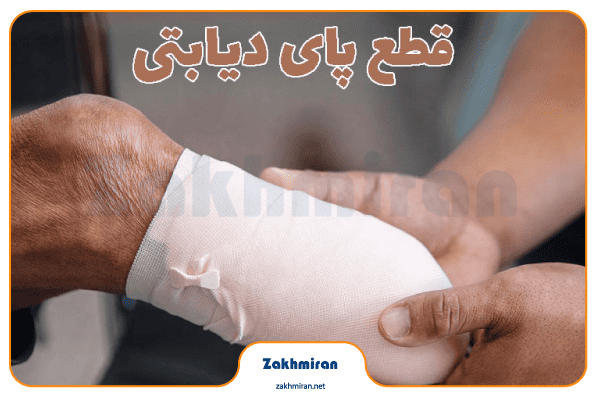 زخم پای دیابتی 13 آیا زخم پای دیابتی خطرناک است؟