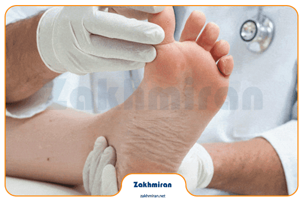 آیا می‌توان زخم دیابتی را در خانه درمان کرد؟