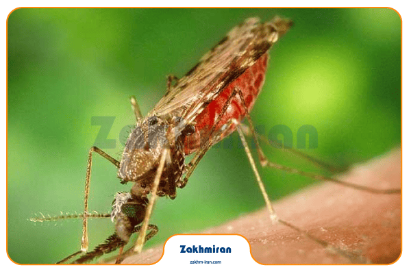 بیماری سالک 6 علت به وجود آمدن سالک