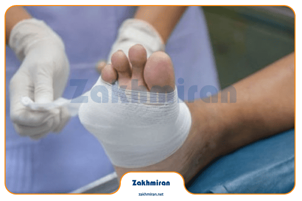 زخم پای دیابتی 7 چه پانسمانی برای زخم دیابتی خوب است؟