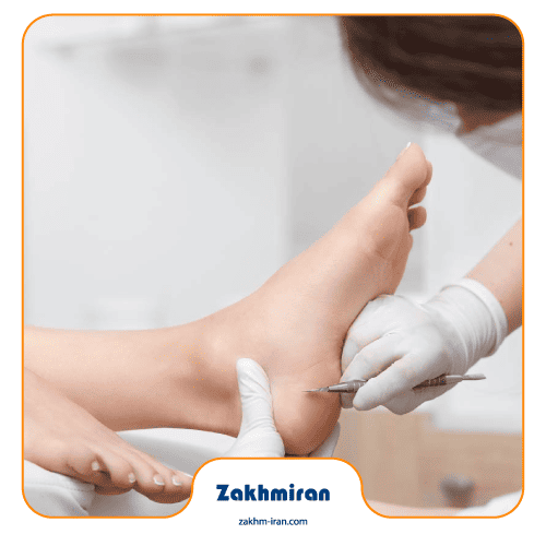 دبرید کردن زخم چیست؟